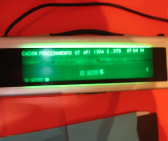 Interpretación de Placas Radiográficas